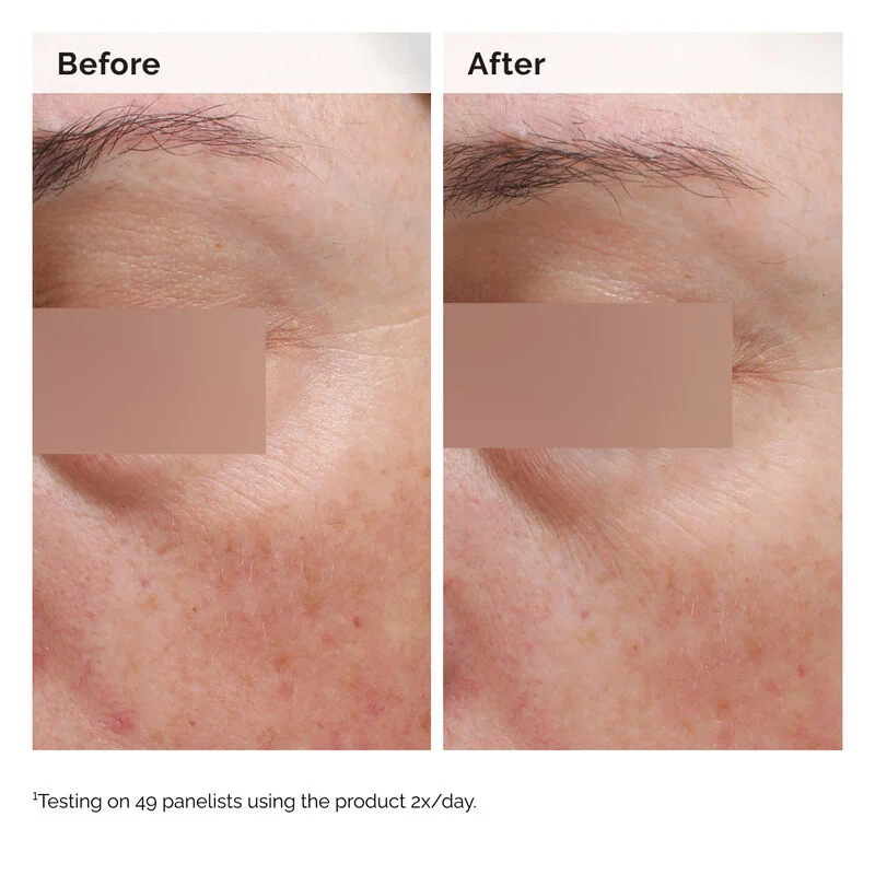 Niacinamide 5% Face and Body Emulsion - Image 4