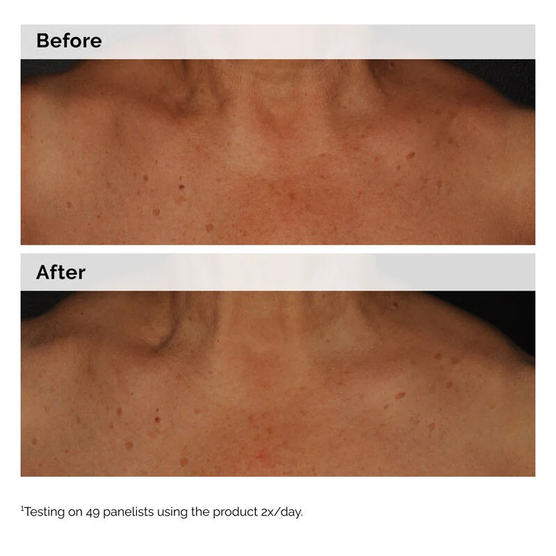 Niacinamide 5% Face and Body Emulsion - Image 5