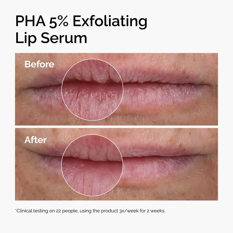 PHA 5% Exfoliating Lip Serum - Image 5